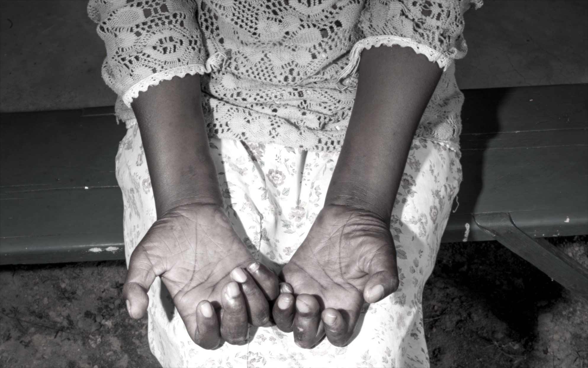 Japan's bishops sorry for failing leprosy sufferers | Catholic News