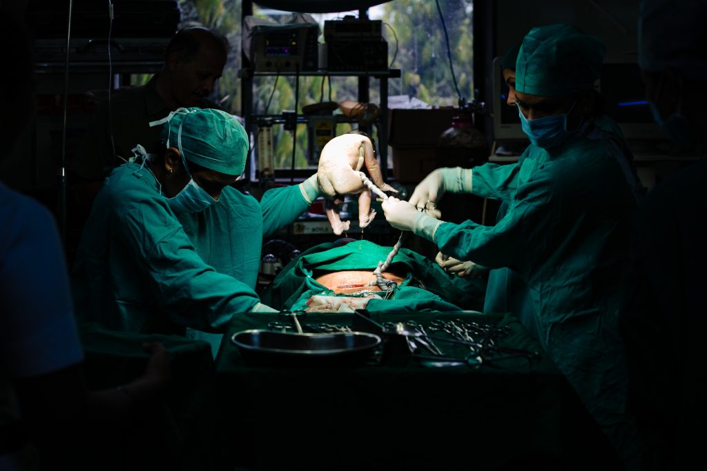 Baby being delivered in operating theater